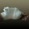 thumbnail for item An arm in bandage