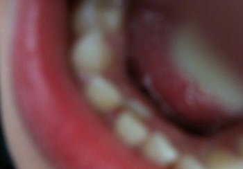 story image about causes and hatred